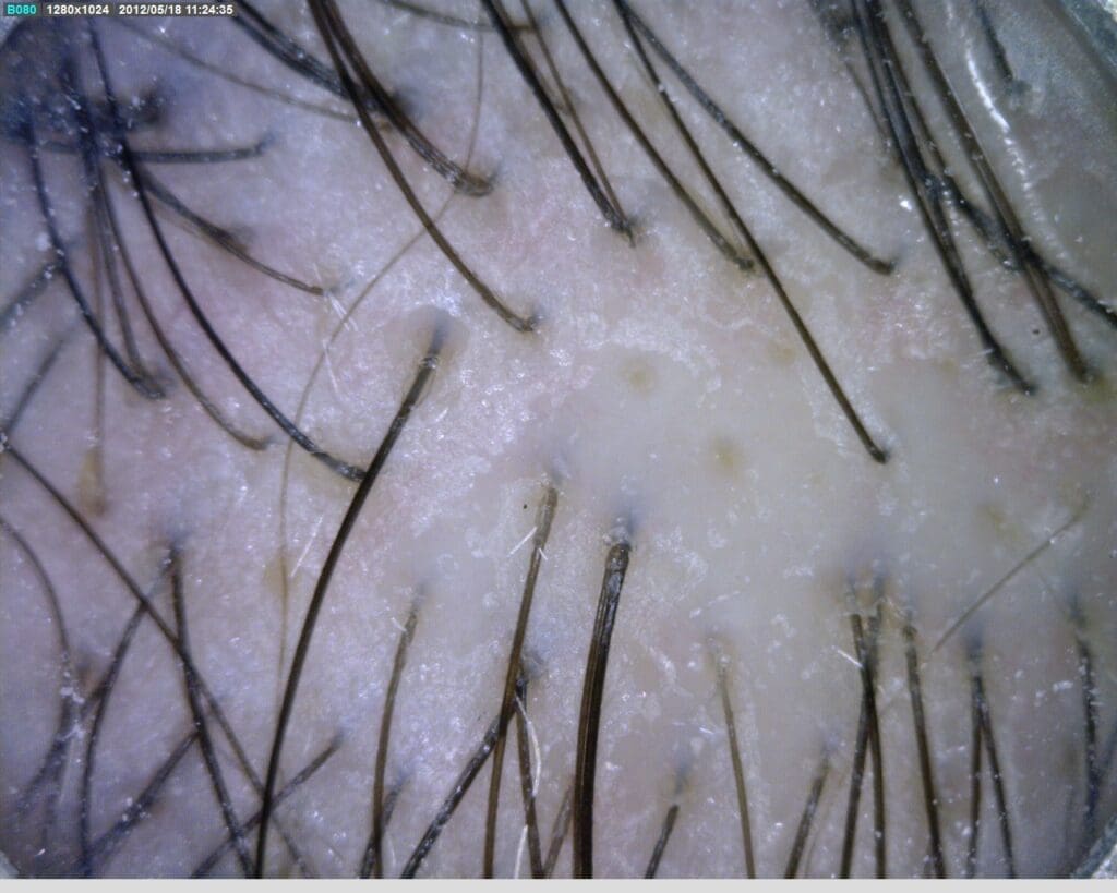 antonucci dermatologia bologna videodermatoscopia